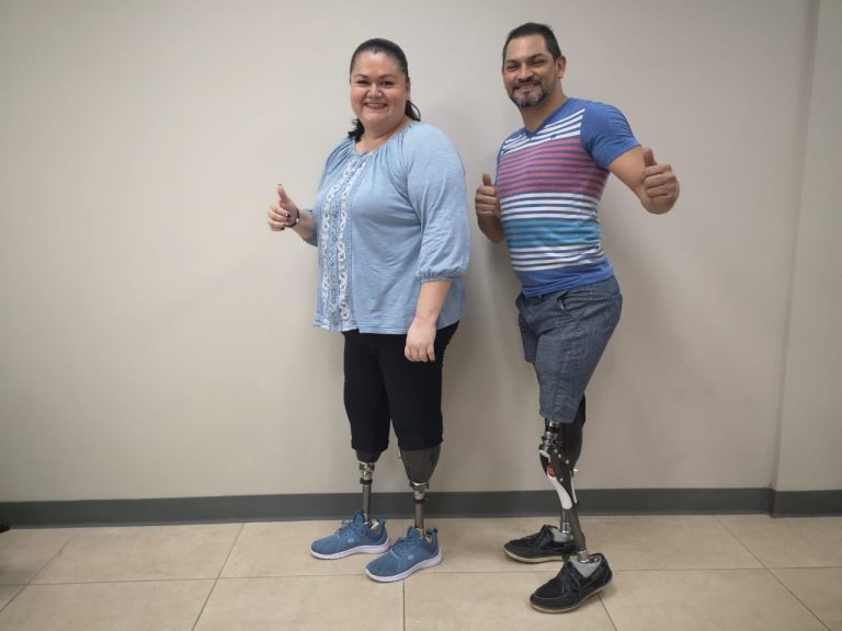 AMPUTADOS MOSTRARÁN LOS RESULTADOS DE SU REHABILITACIÓN