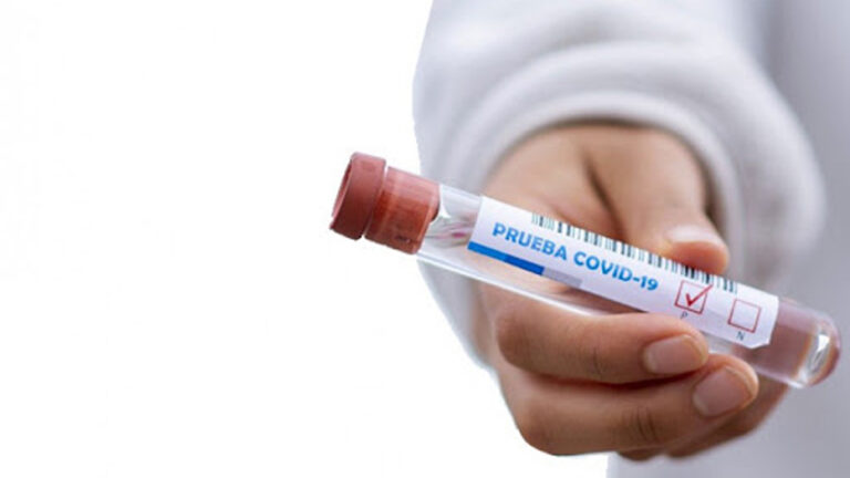 AUTORIZAN PRIMERA IMPORTACIÓN DE AUTOPRUEBAS COVID