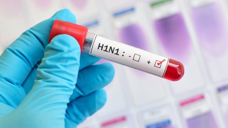CONOZCA MÁS SOBRE LA INFLUENZA H1N1