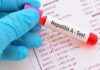 MINISTERIO DE SALUD ALERTA SOBRE BROTE DE HEPATITIS A